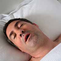 Sleep apnea describes interruption in breathing during sleep. Central sleep apnea is the result of faulty signals from the brain that trigger muscles to perform breathing processes.