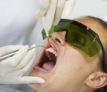 Laser treatment for gum disease in Glen Allen, VA area